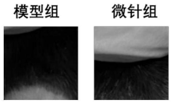 Hair growth microneedle patch containing androgen receptor protein targeted complex as well as preparation method and application of hair growth microneedle patch