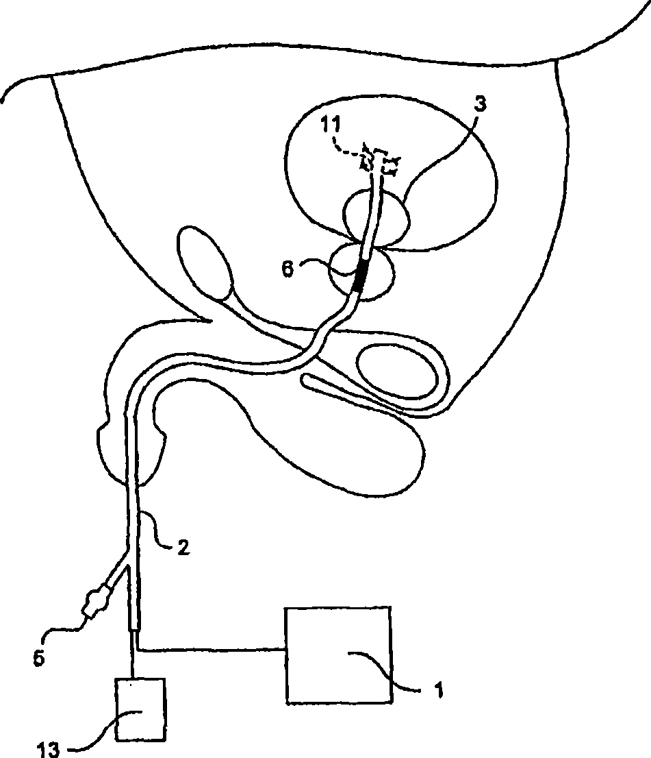 Method and apparatus for photoactivation medicament treatment