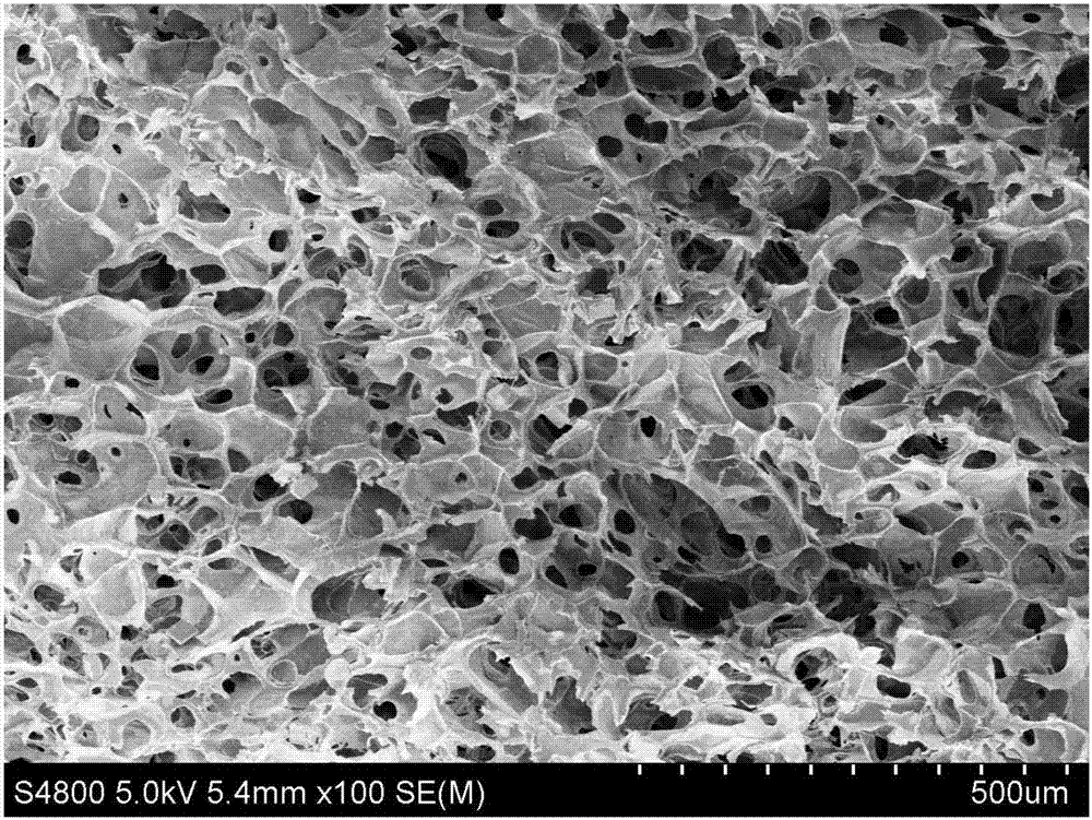 Three-dimensional porous support material of spherical mesoporous calcium silicate/chitosan, preparation method and application