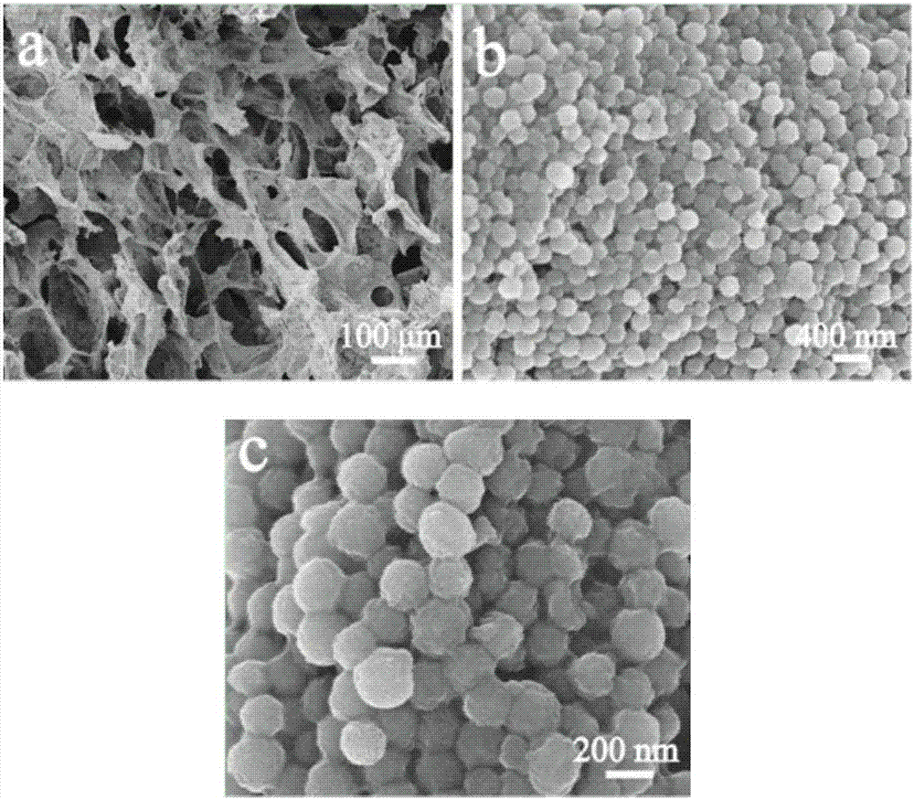 Three-dimensional porous support material of spherical mesoporous calcium silicate/chitosan, preparation method and application