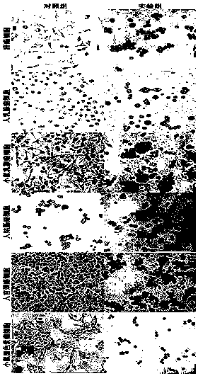 Application of a strain of Bacillus lysinus globosa and its crystal protein and active product