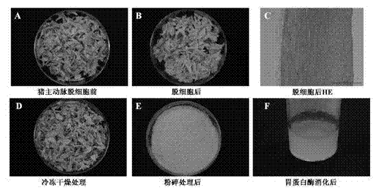Decellularized blood vessel matrix gel, preparation method therefor and applications thereof