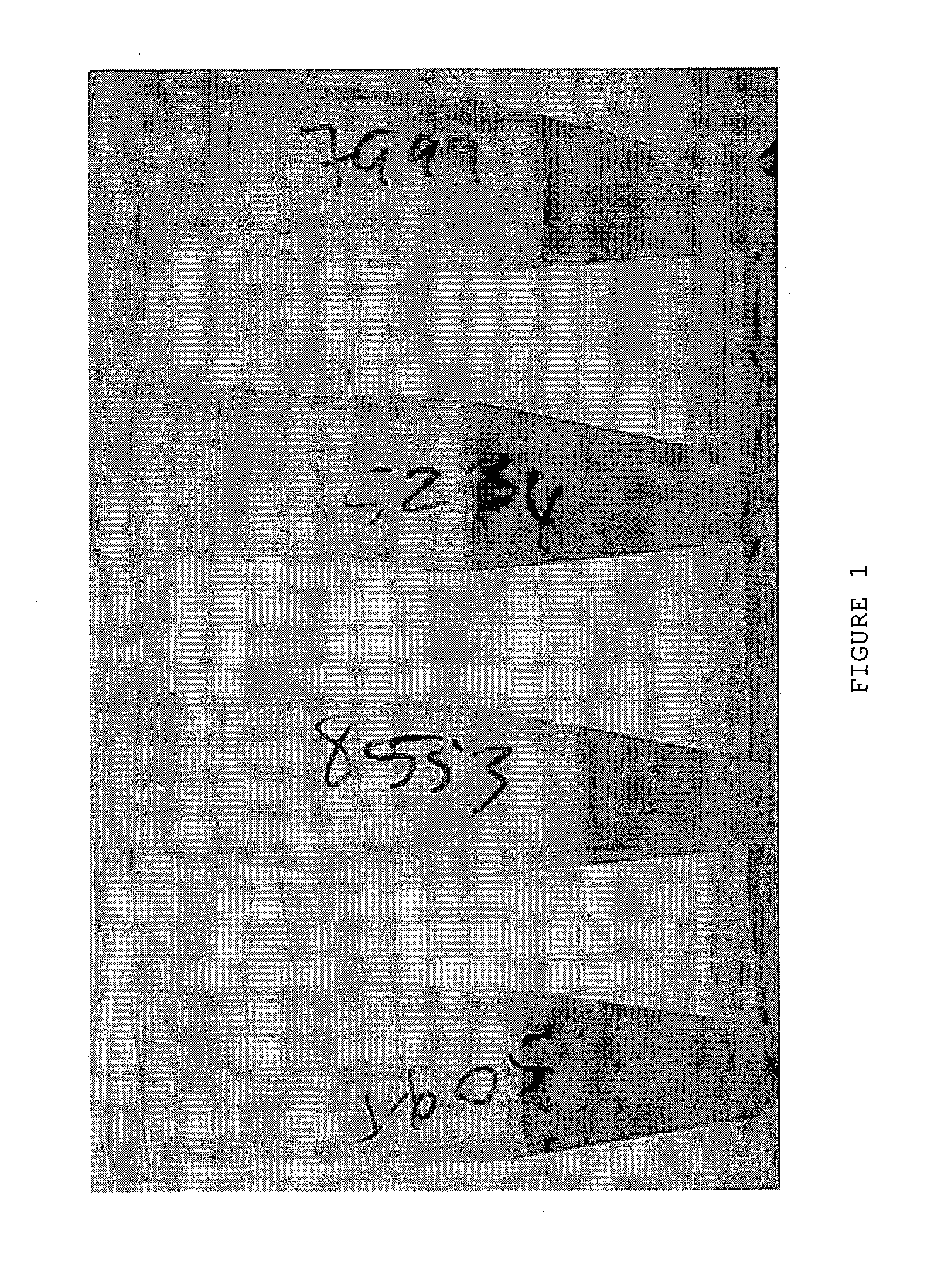 Method of modifying the immune response