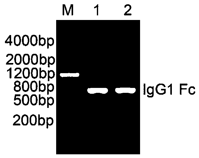 Interleukin 39 specific antagonistic protein and application thereof in treating autoimmune diseases