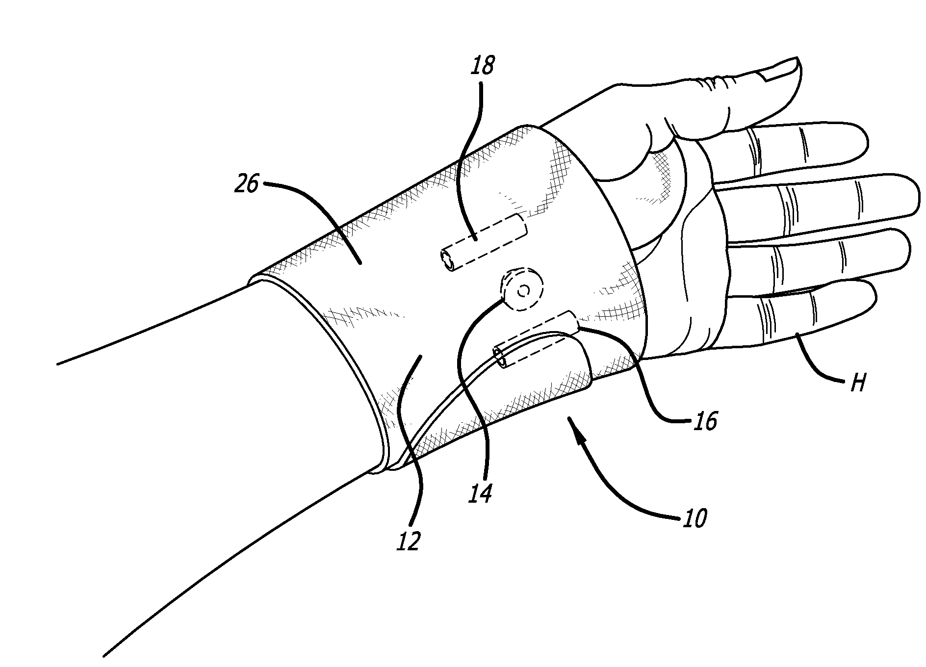 Wrist brace and method for alleviating and preventing wrist pain