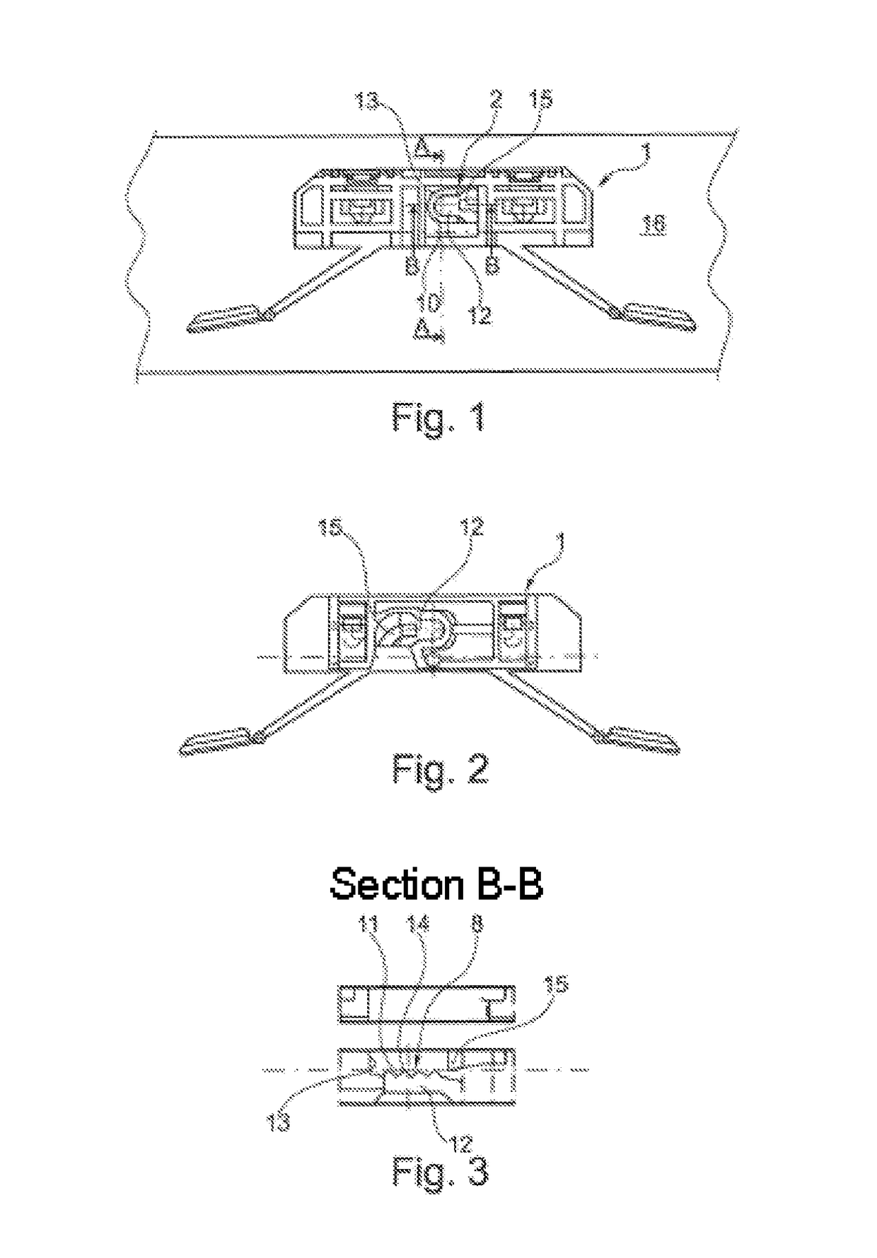 Clipwave System