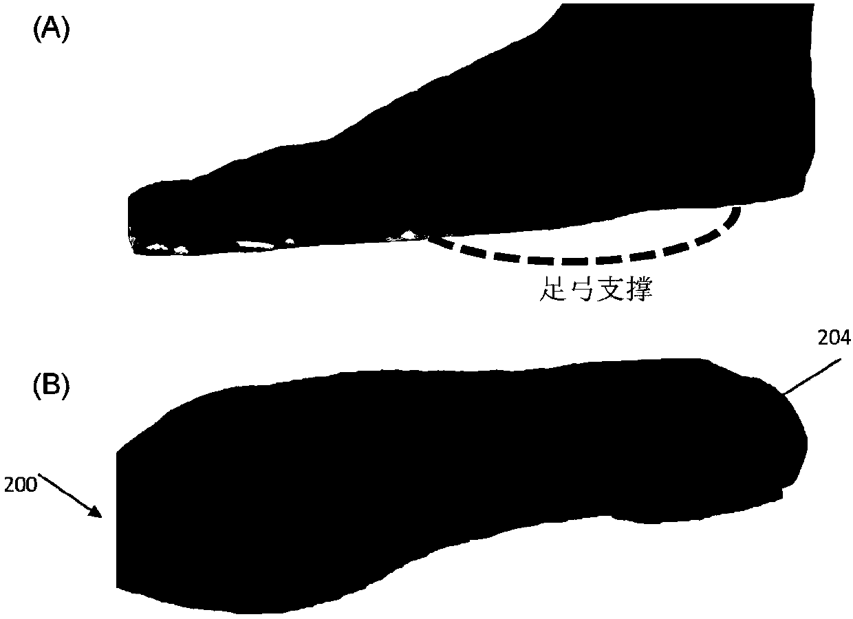 Injury reduction insole