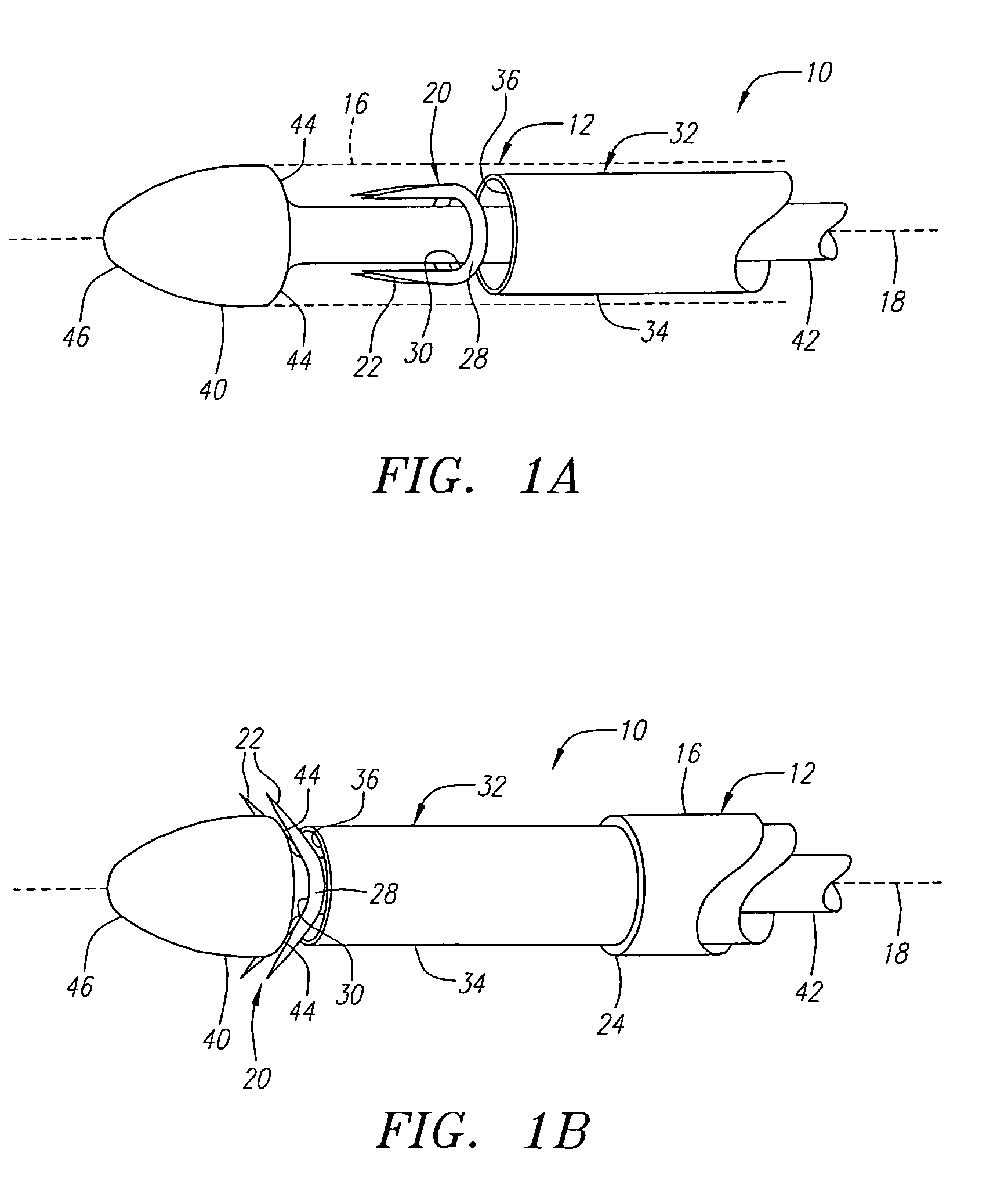 Apparatus and methods for reducing lung volume