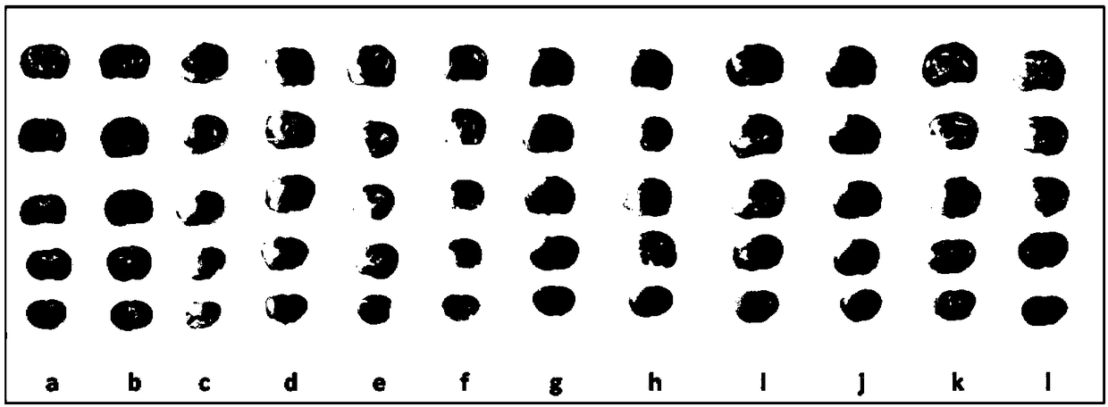 Therapeutic Peptides for Excitotoxicity-Related Injuries