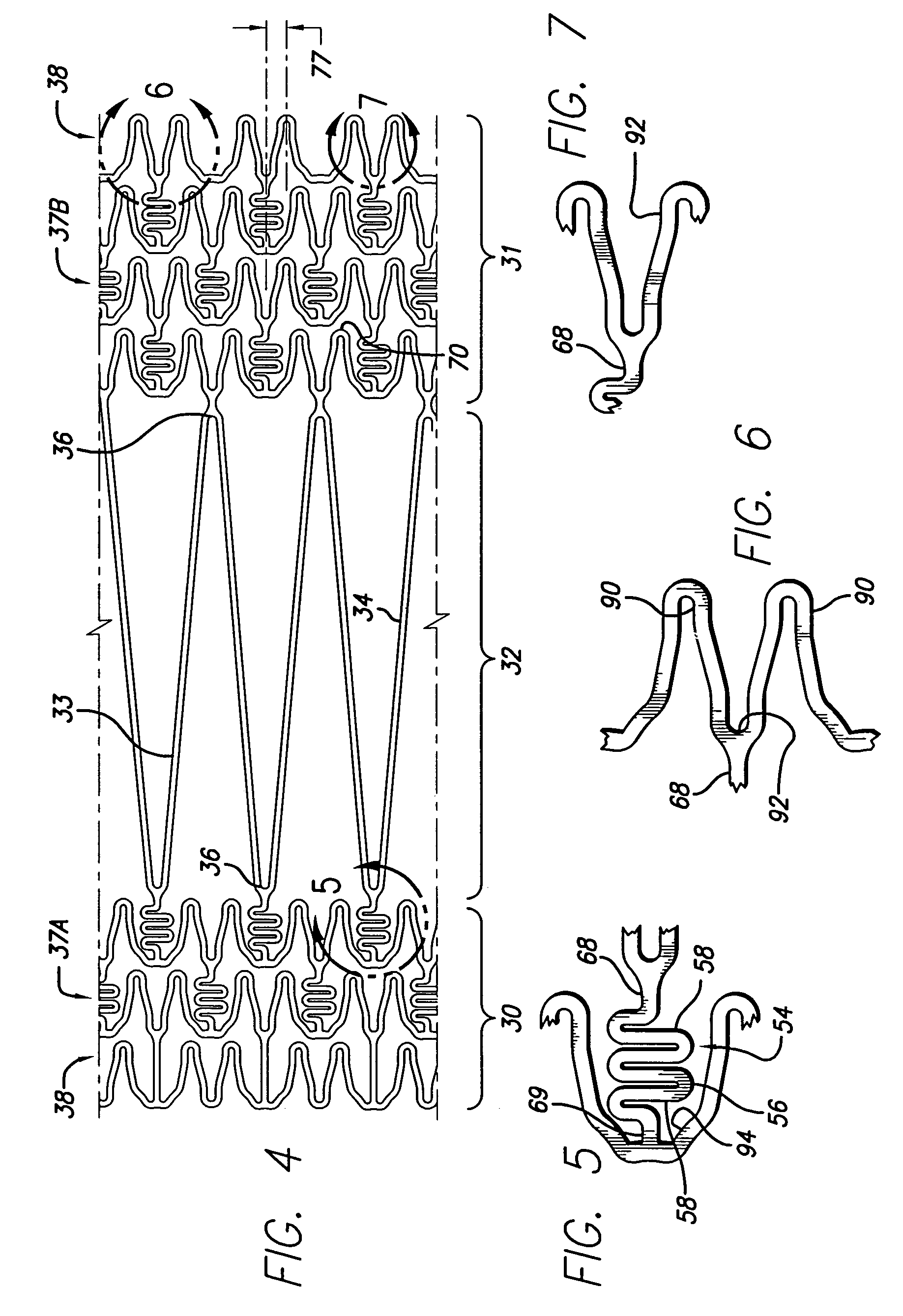 Intravascular stent and method of use