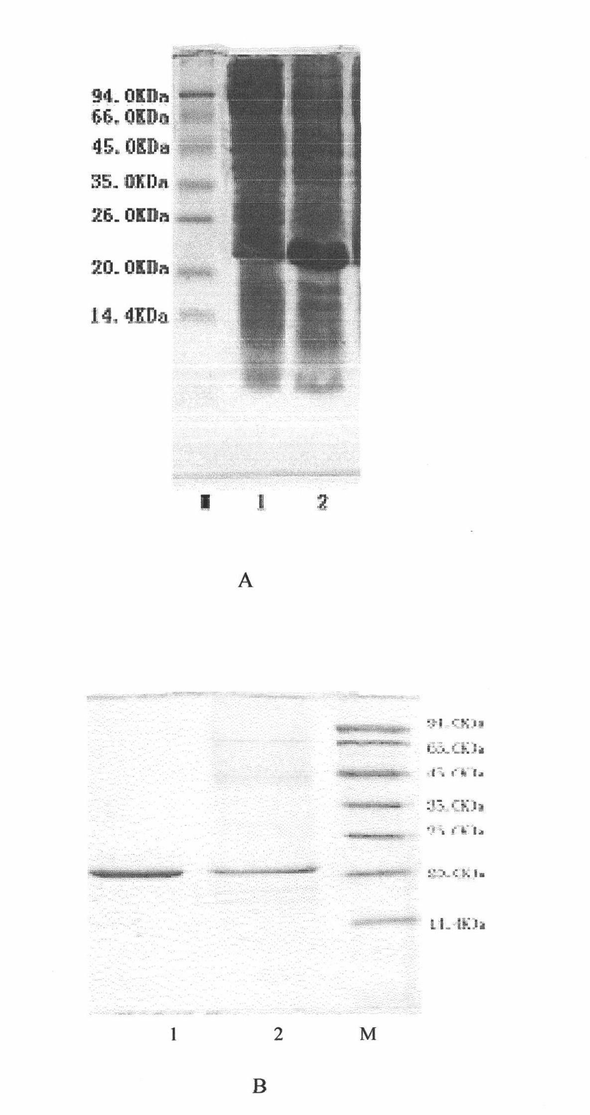 Liposome-encapsulated recombinant human ciliary neurotrophic factor