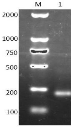 tsm1 polypeptide and its application in the preparation of anti-complement drugs