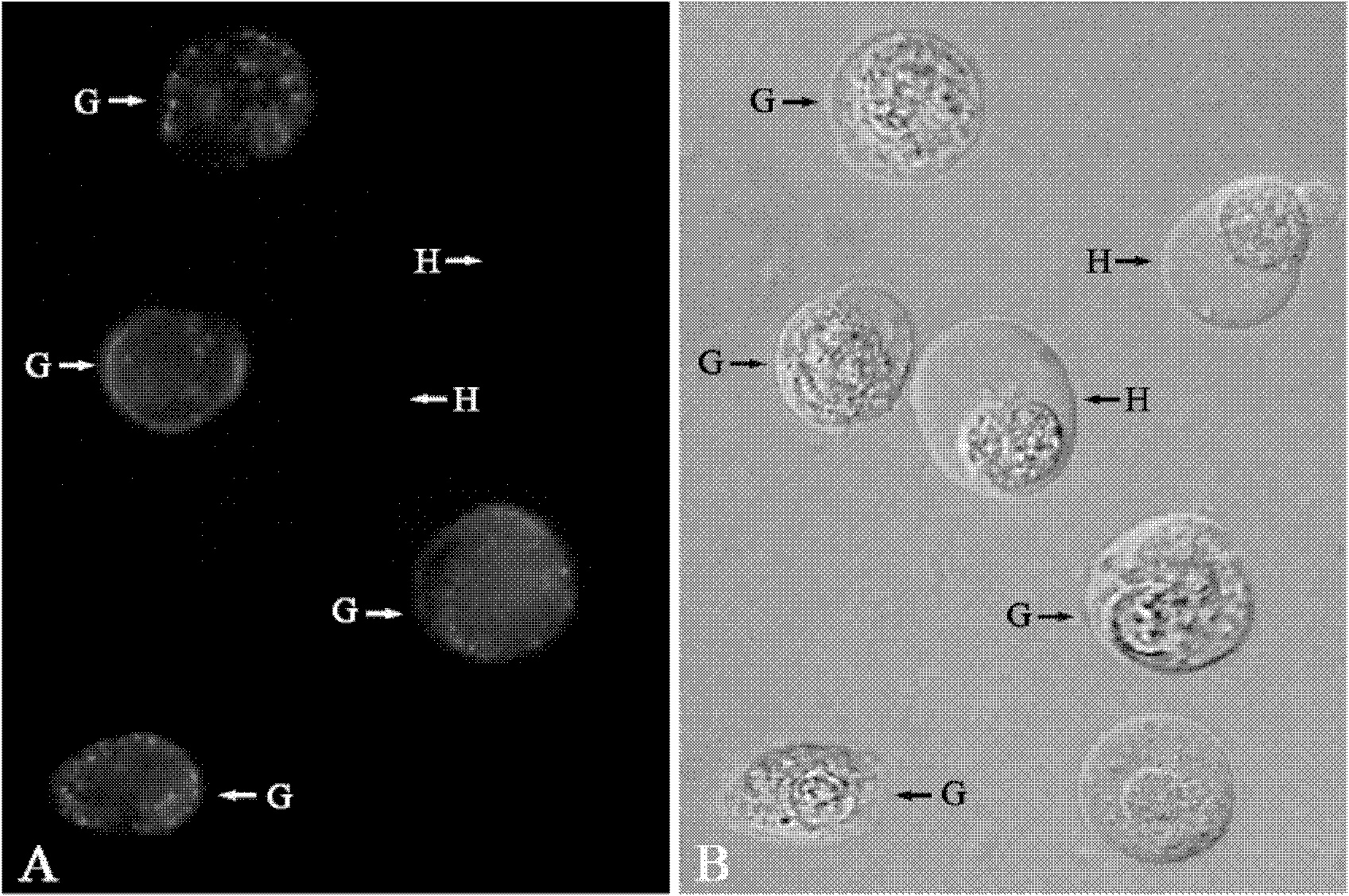 Monoclonal antibody capable of resisting chlamys farrei particle blood corpuscle and preparation method thereof