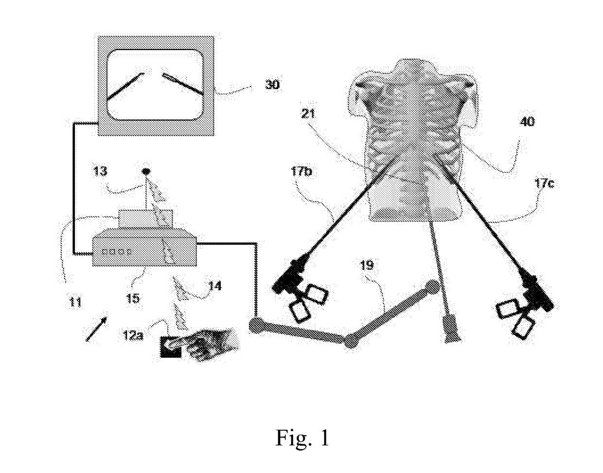 Device and method for assisting laparoscopic surgery utilizing a touch screen