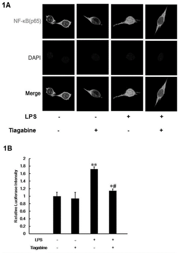 Applications of tiagabine in preparing medicines for treating dopaminergic neuron injuries