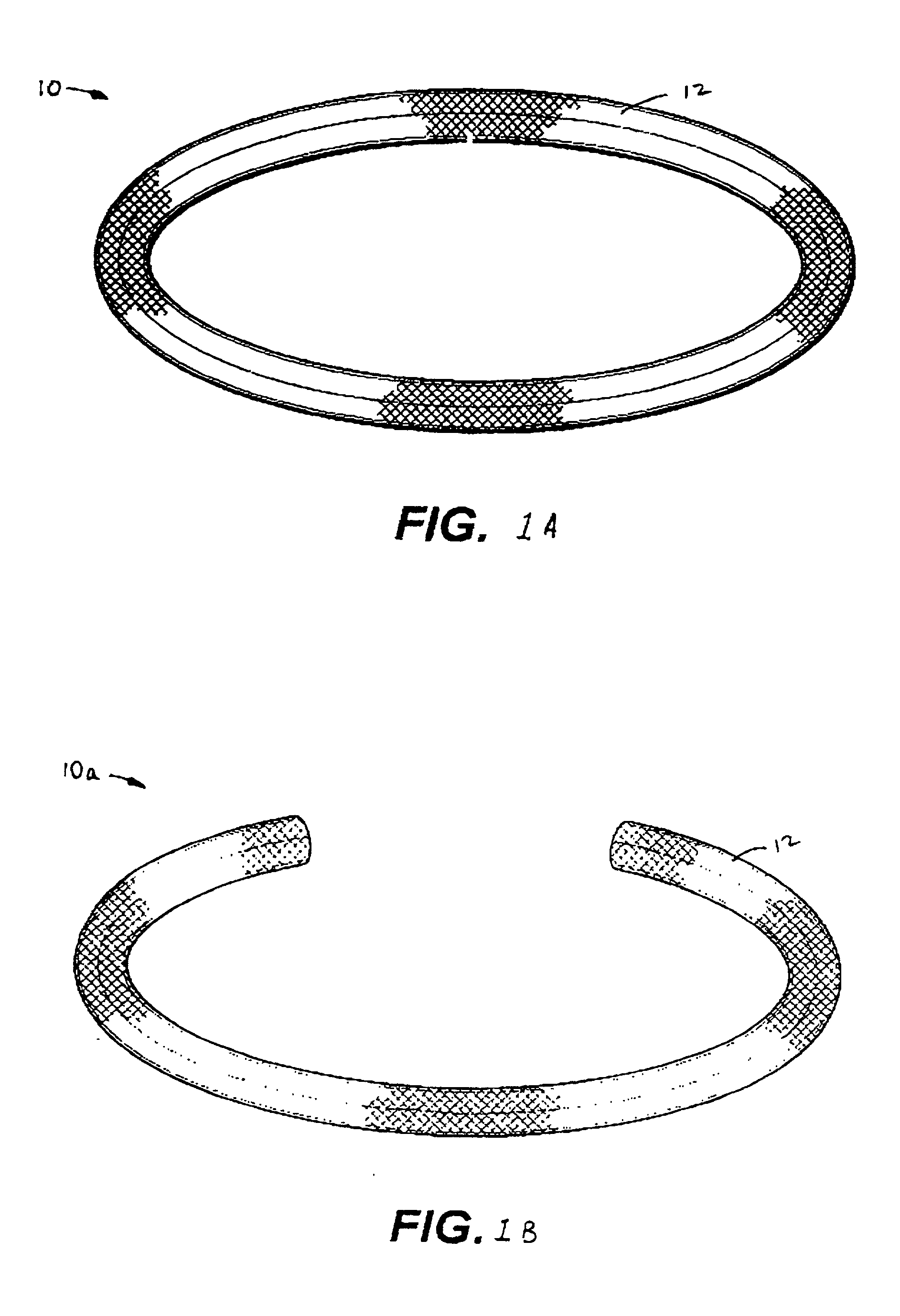 Antimicrobial annuloplasty ring having a biodegradable insert