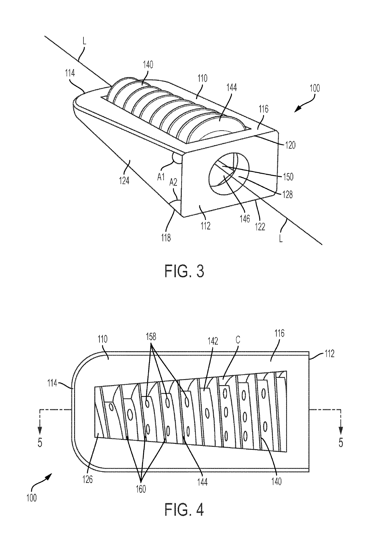 Distal Radius Wedge Screw