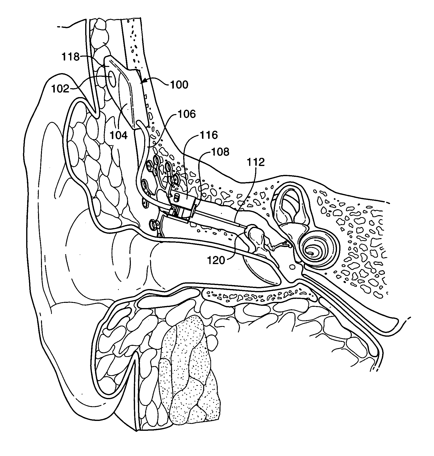 Transducer to actuator interface