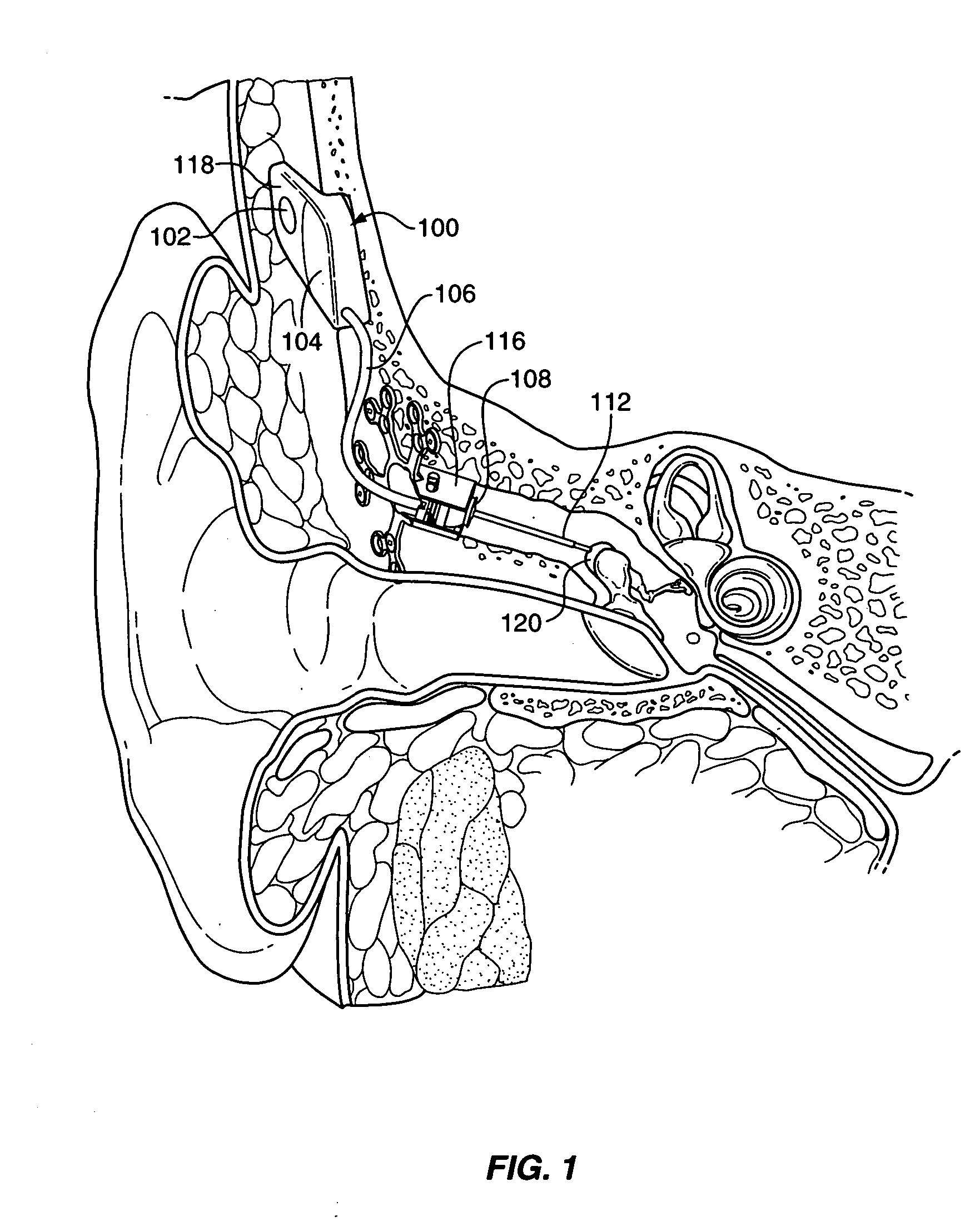 Transducer to actuator interface