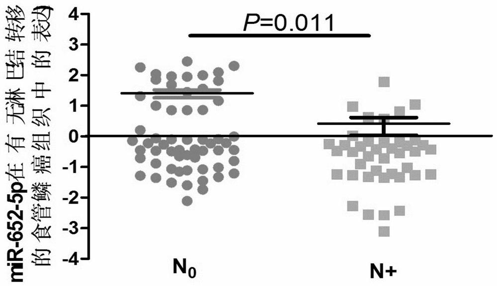 The application of the marker mir-652-5p on the metastasis, prognosis and treatment of esophageal squamous cell carcinoma in drugs and kits