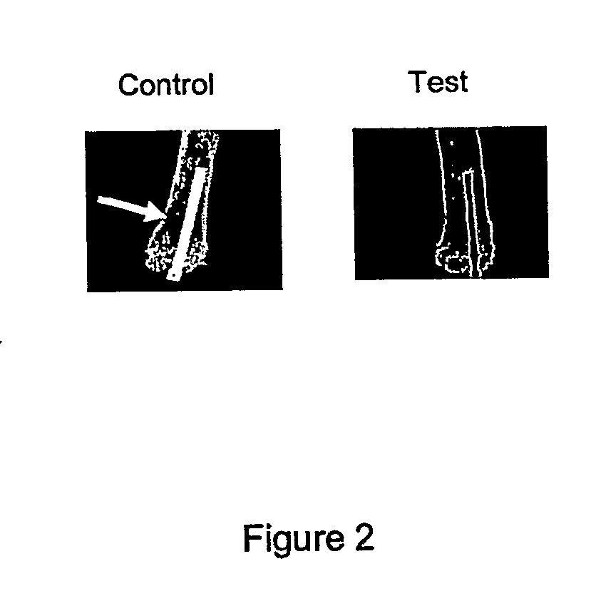 Methods and Compositions for Improving the Incorporation of Orthopaedic and Orthodontic Implants