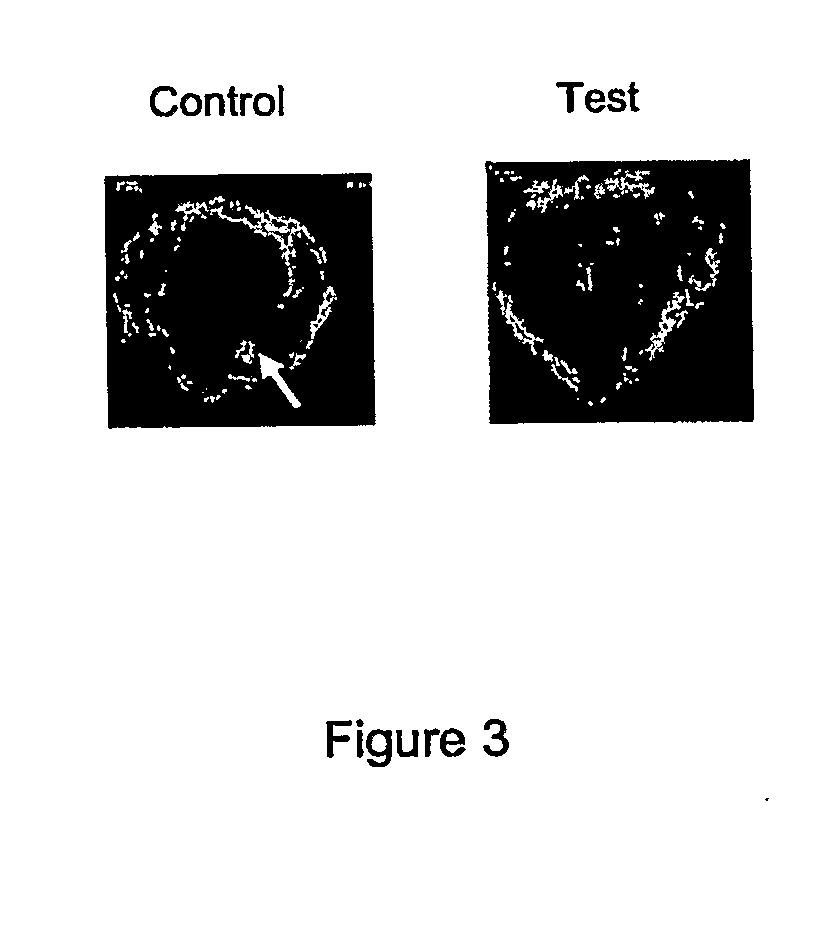 Methods and Compositions for Improving the Incorporation of Orthopaedic and Orthodontic Implants