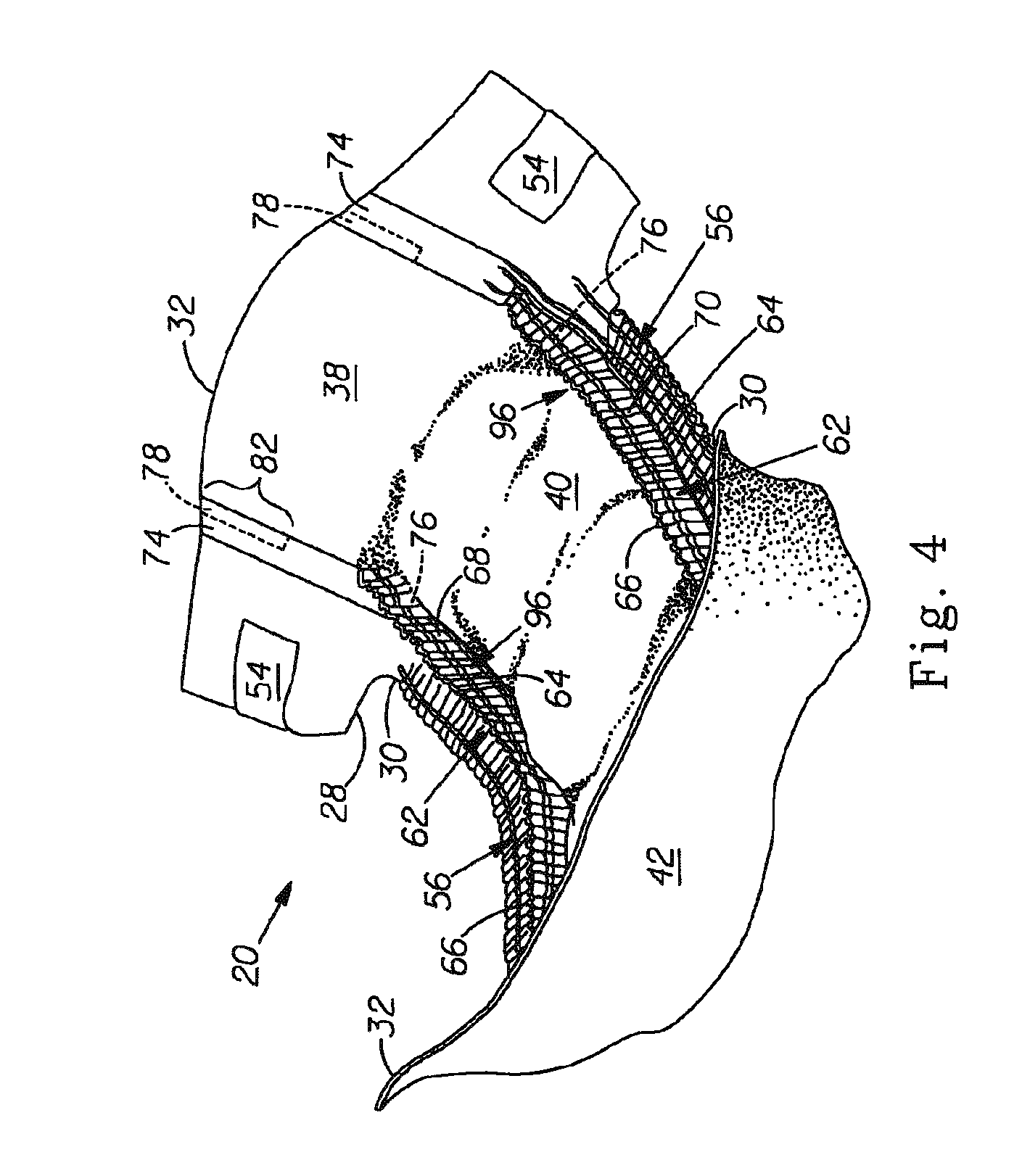 Barrier cuff for a unitary disposable absorbent article having intermediate bond for sustained fit