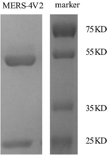 Monoclonal antibody MERS-4V2 and encoding gene and application thereof