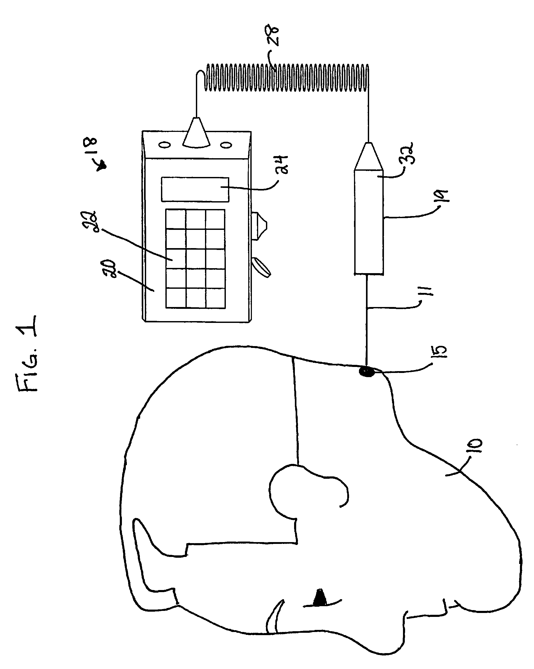 Adjustable Polarity Laser Device and Polarized Low-Level Laser Therapy Method