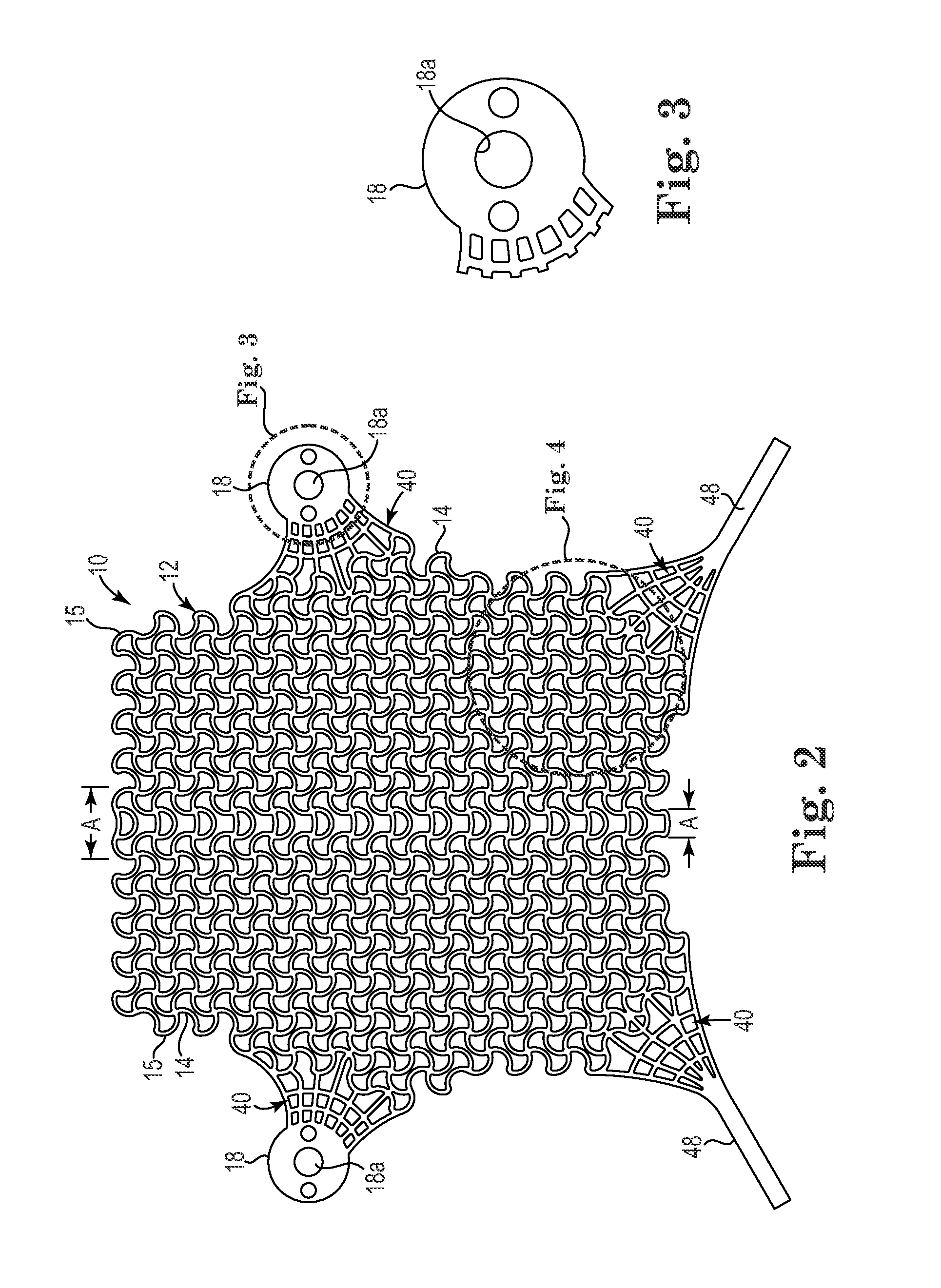 Patterned Implant and Method