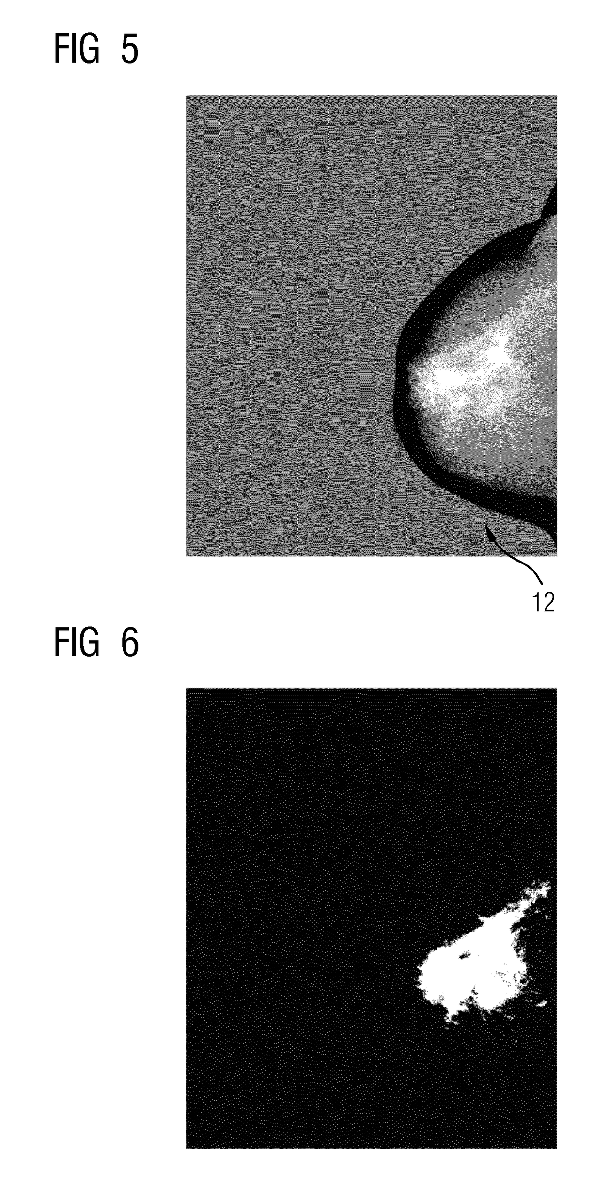 Evaluation of an x-ray image of a breast produced during a mammography
