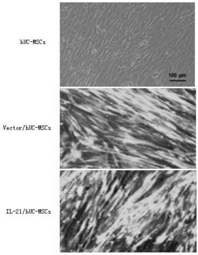 Recombinant mesenchymal stem cell and application thereof