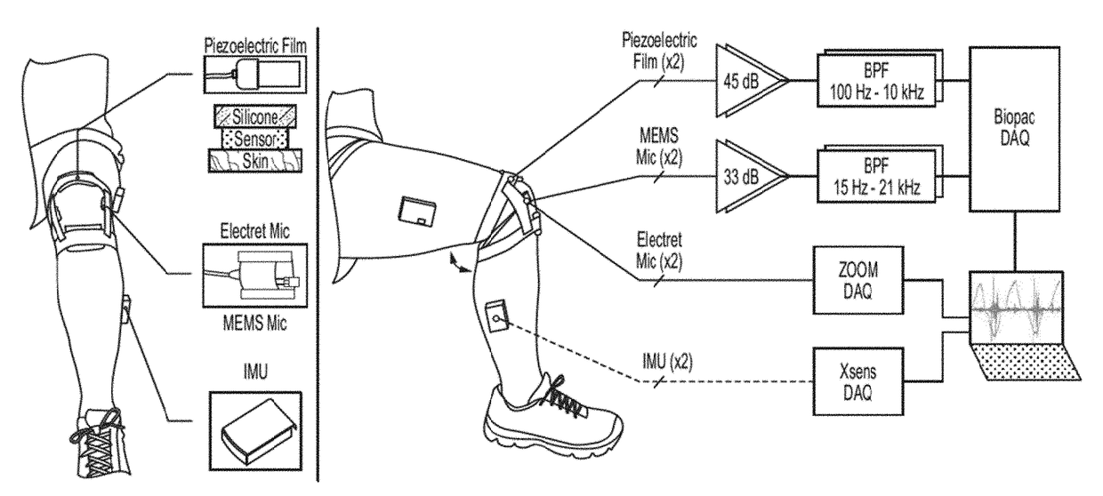 Wearable Technologies For Joint Health Assessment
