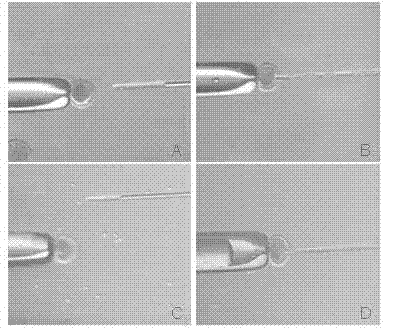 Method for improving transferring efficiencies of pig somatic cell nucleuses