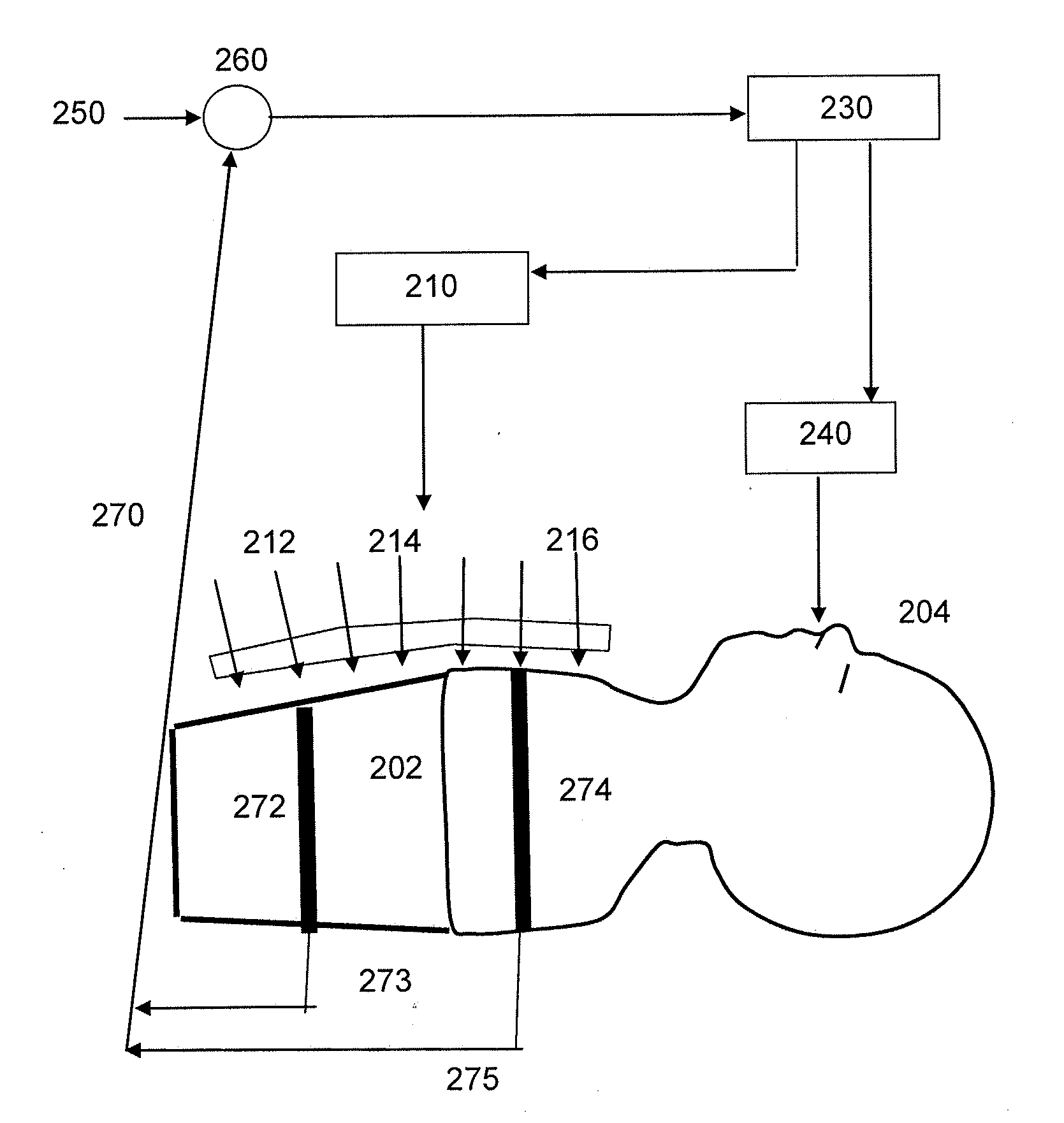Extrathoracic Augmentation of the Respiratory Pump