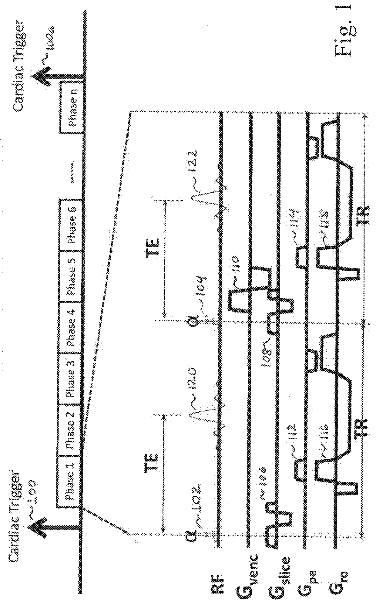 Cine phase contrast simultaneous multi-slice and multi-slab imaging of blood flow and cerebrospinal fluid motion