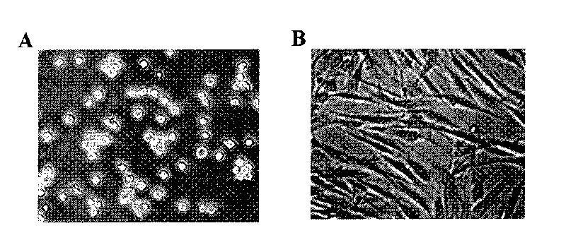 Method for preparing monocyte type stem cell and application