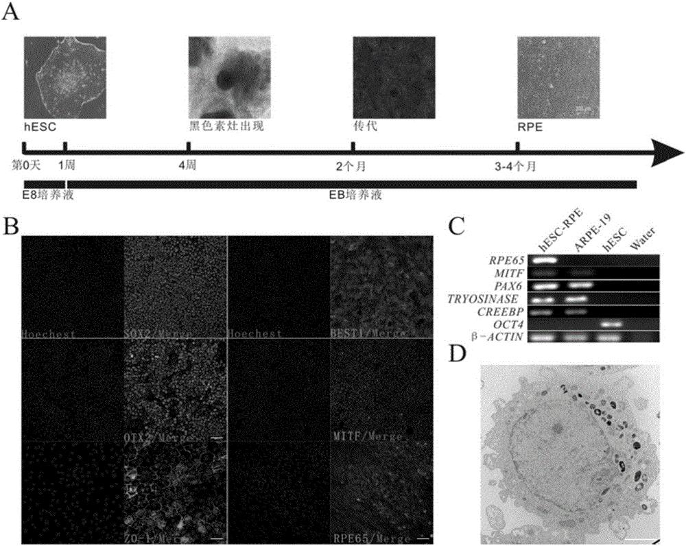 Culture solution for retinal pigment epitheliums and preparation method and application thereof