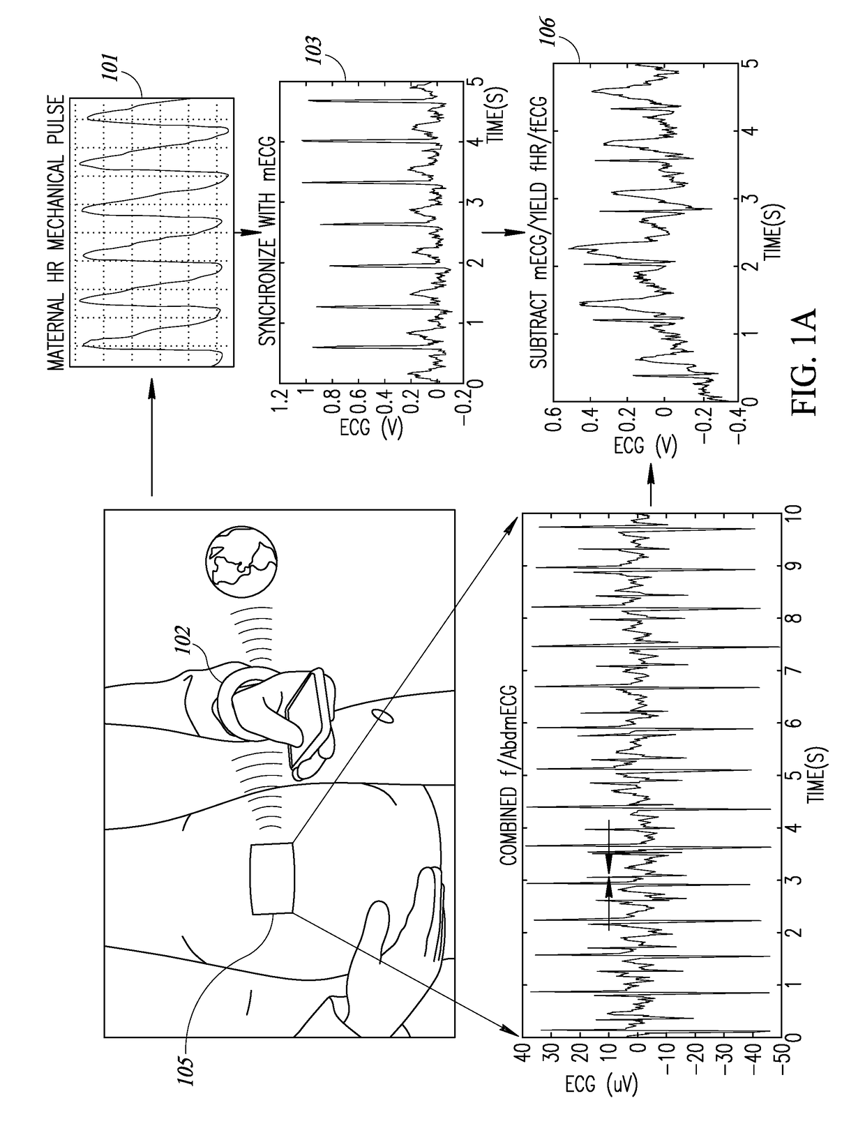 Fetal ECG and heart rate assessment and monitoring device