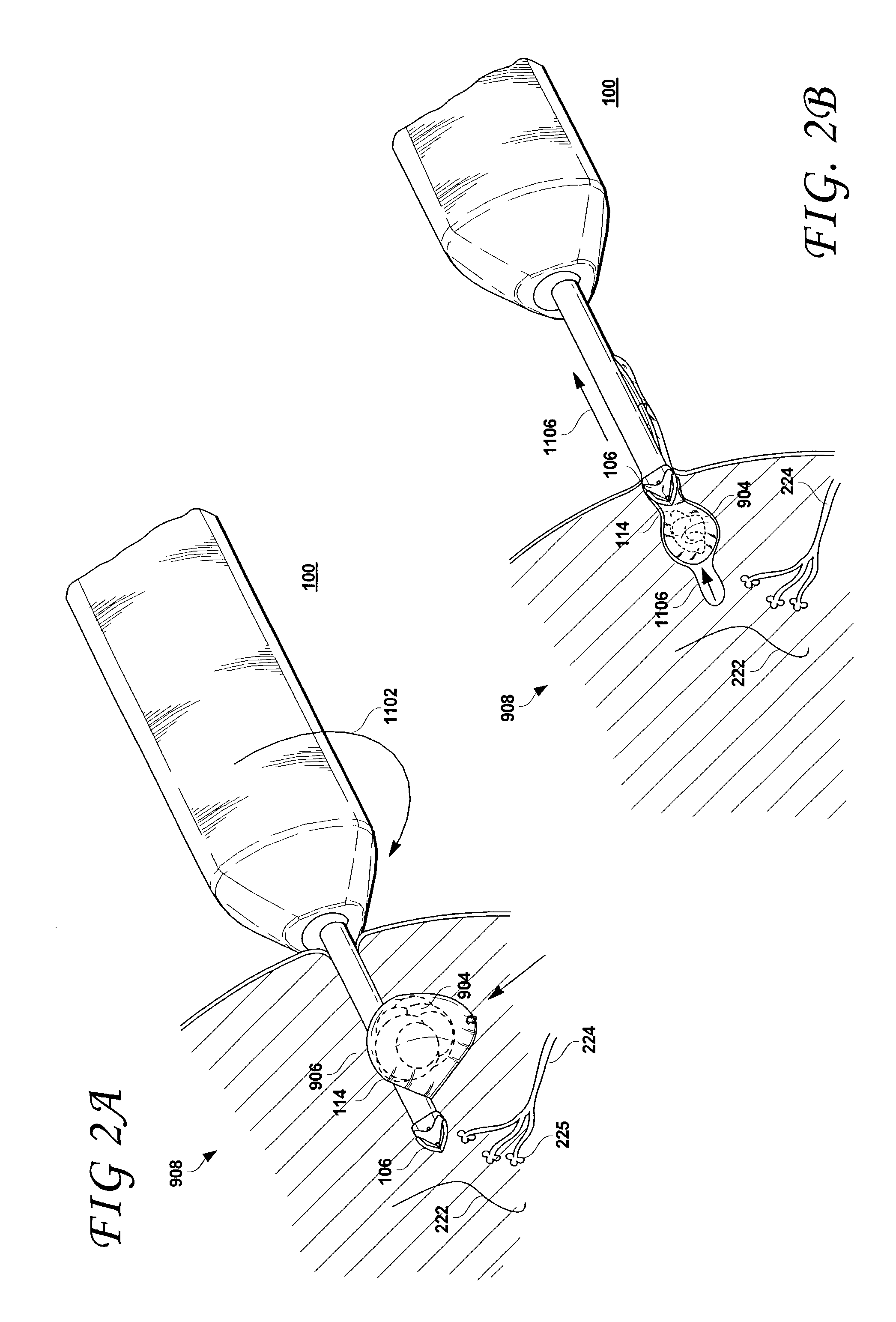 Excisional devices having selective cutting and atraumatic configurations and methods of using same