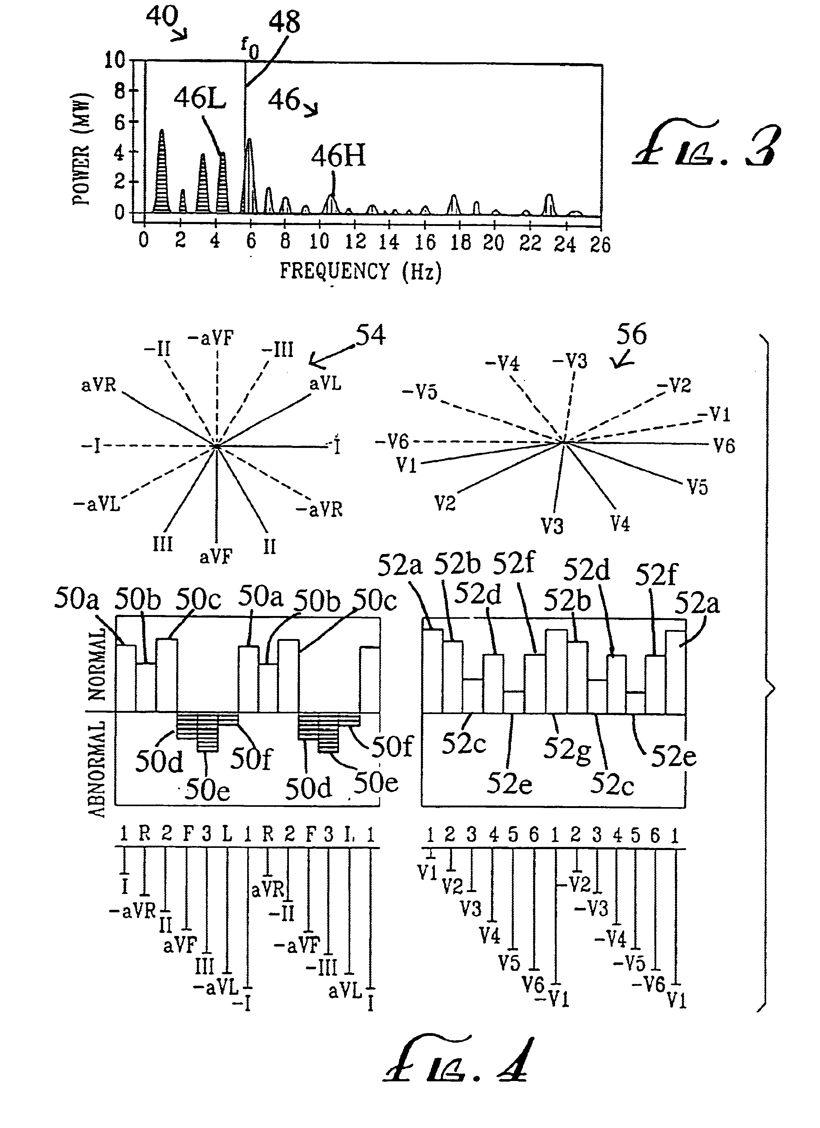 System and method for detecting and locating heart disease