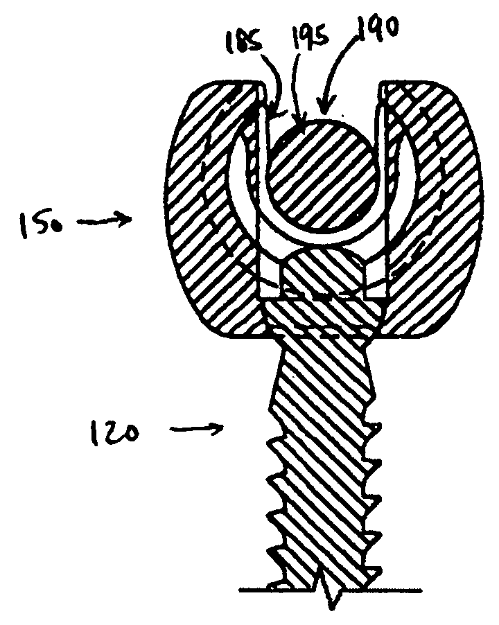 Polyaxial pedicle screw having a rotating locking element