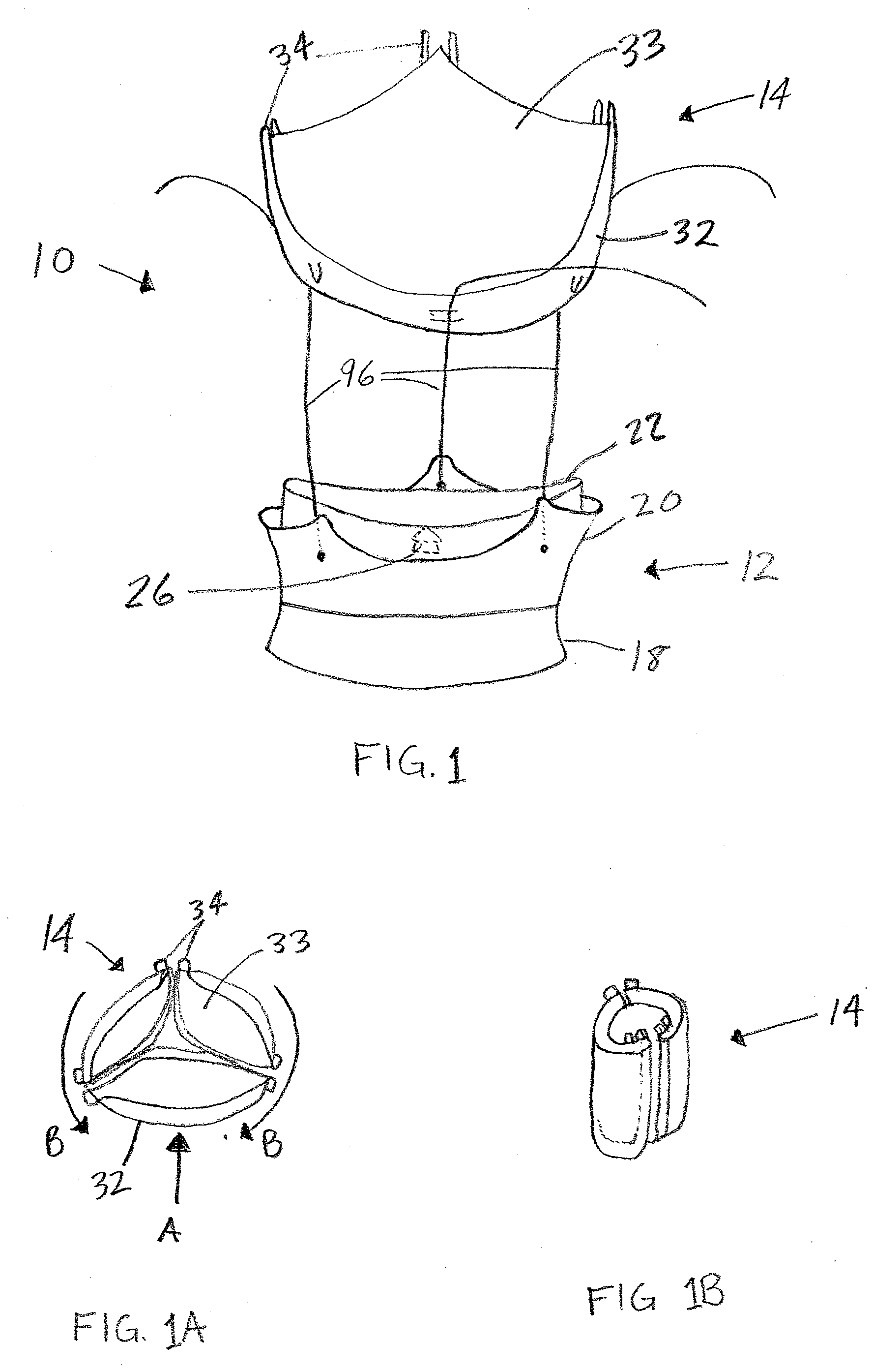 Two-piece percutaneous prosthetic heart valves and methods for making and using them