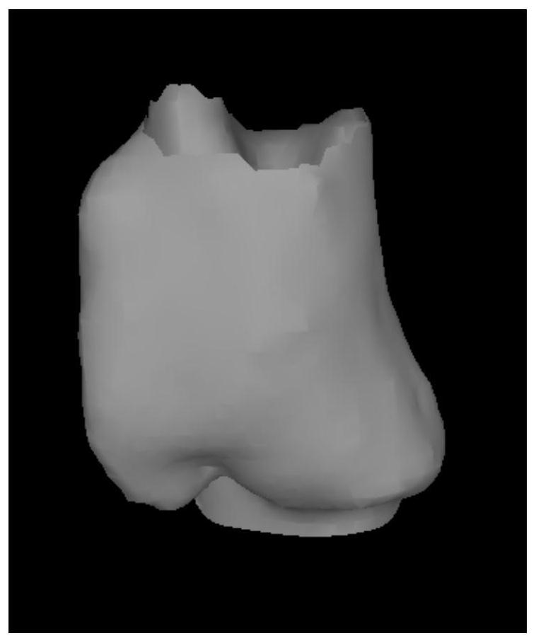 A method and device for determining coronary artery flow reserve fraction ffr