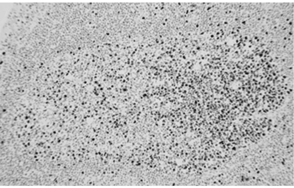 Preparation method and application of ready-to-use antibody reagent (immunohistochemical)