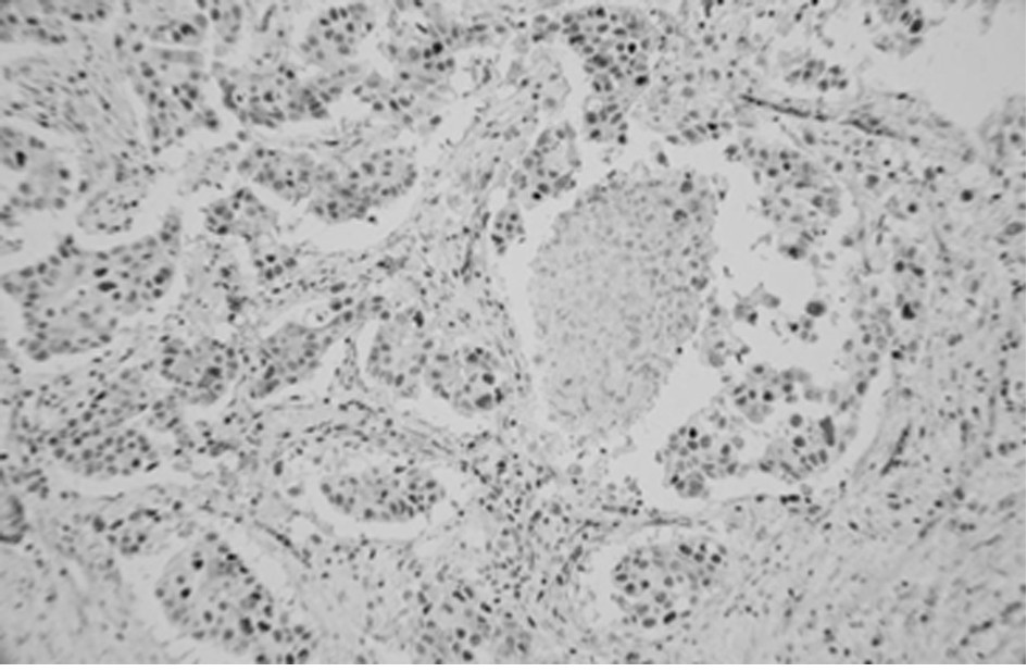 Preparation method and application of ready-to-use antibody reagent (immunohistochemical)