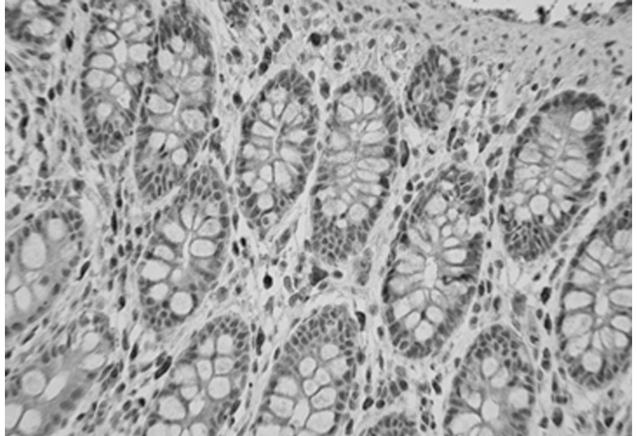 Preparation method and application of ready-to-use antibody reagent (immunohistochemical)