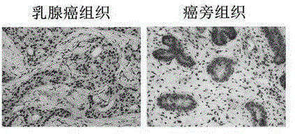 Recombinant lentiviral vector containing ubiquitin-specific protease gene USP39-shRNA (short hairpin ribonucleic acid) and application thereof