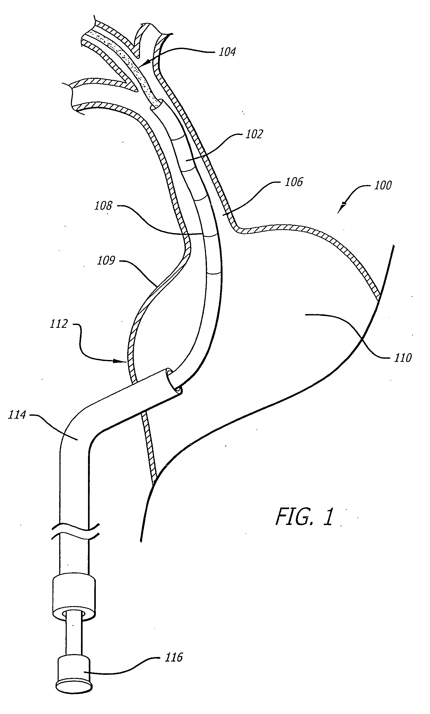 Ablation tools and positioning devices therefor