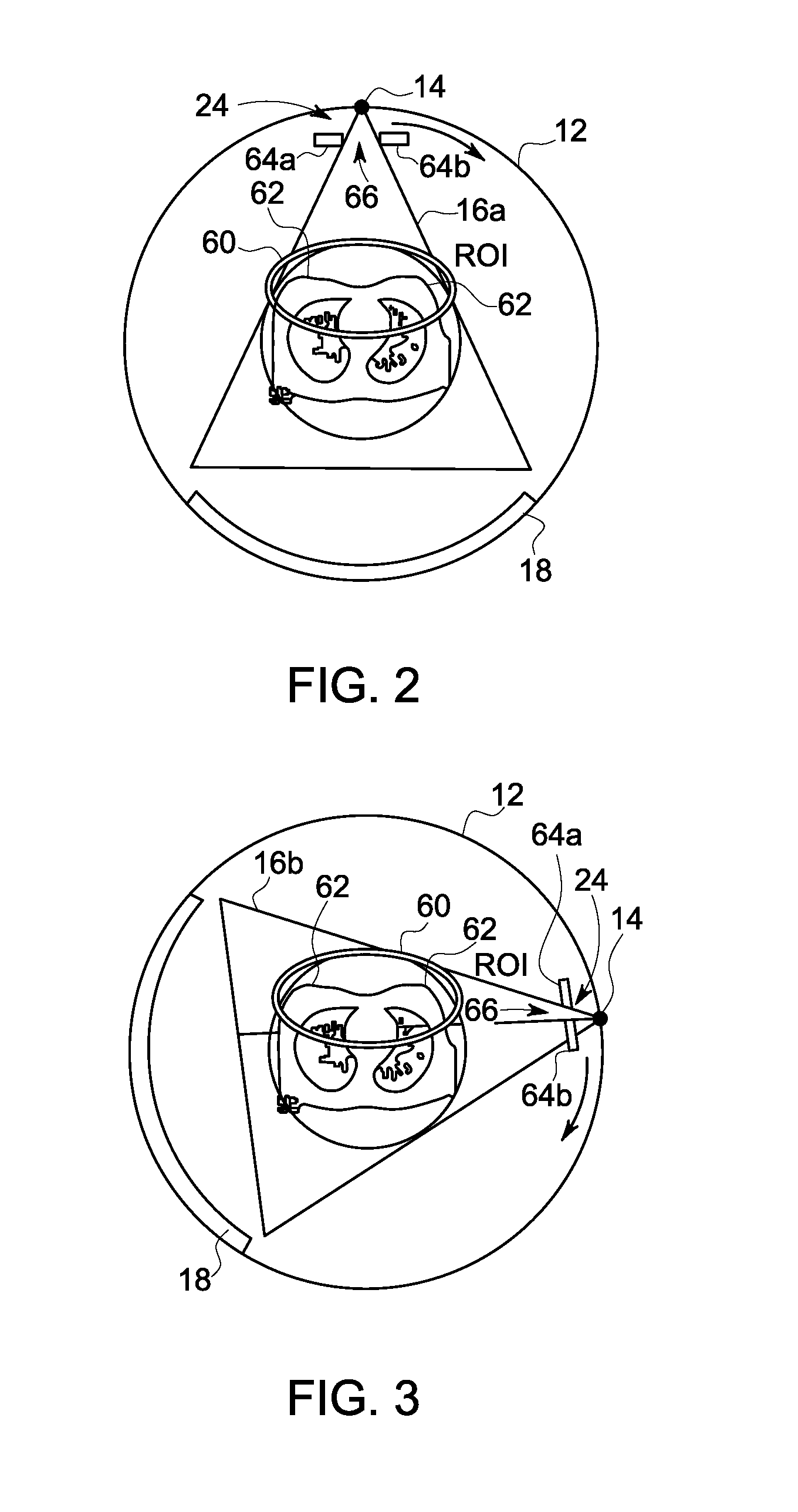 System and method for breast imaging using x-ray computed tomography